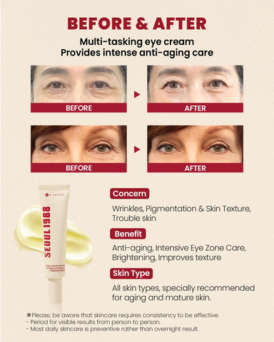 SEOUL 1988 Eye Cream | Anti-Aging & Dark Circle Care